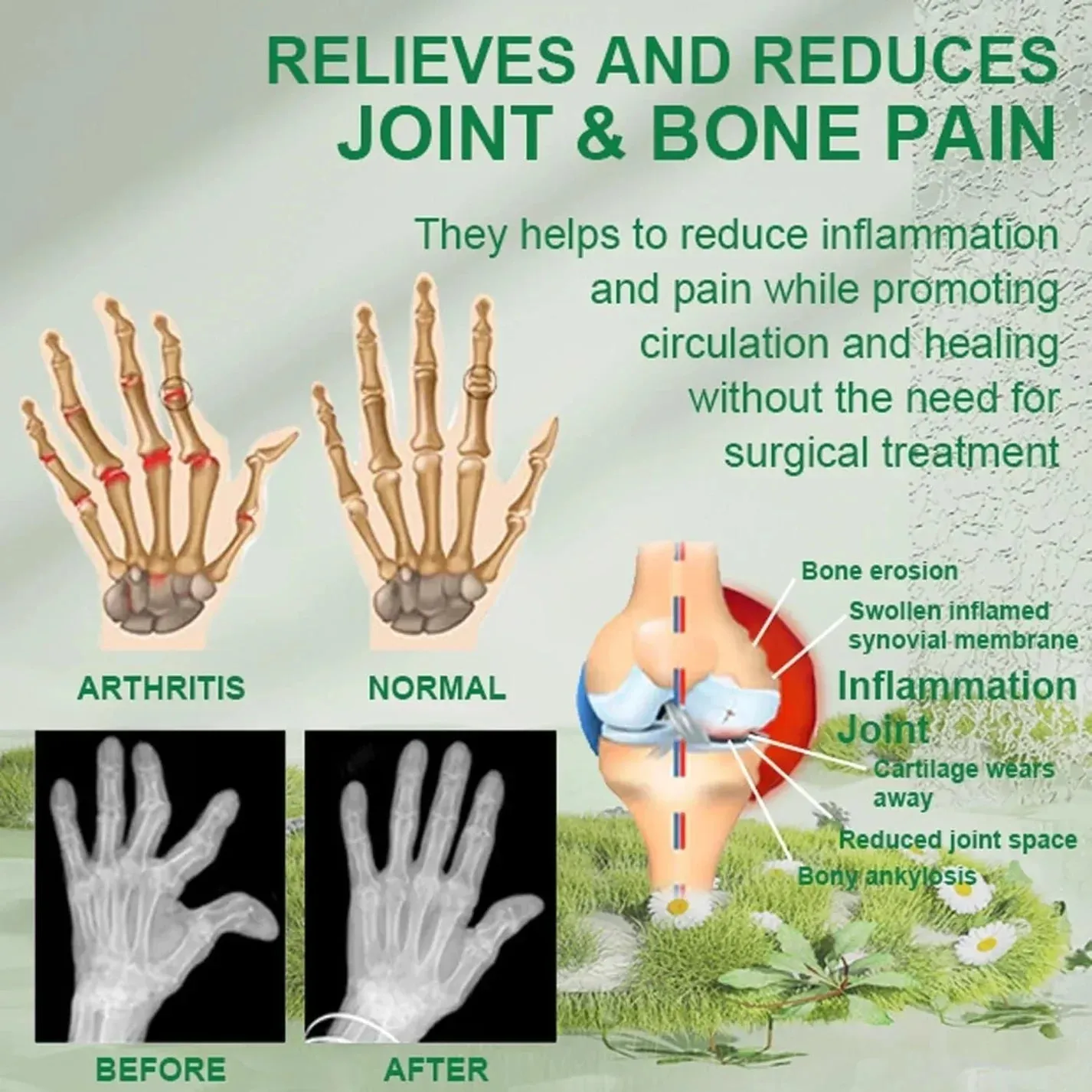 ..Bee Venom Joint and Bone Therapy Cream - ( Buy 1 get 2 Free )