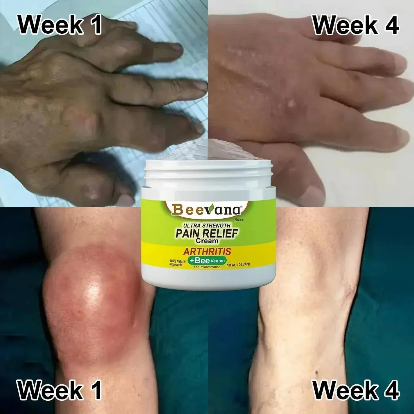 ..Bee Venom Joint and Bone Therapy Cream - ( Buy 1 get 2 Free )