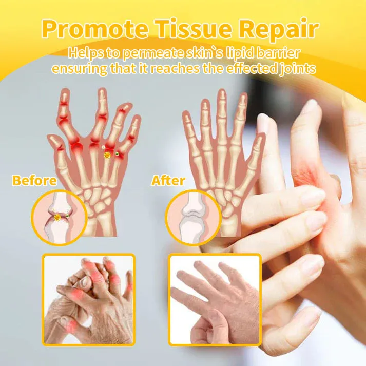 Flysmus™ Bee Venom Pain-Relief Bone Healing Cream(Specially for older adults & AOA recommends)