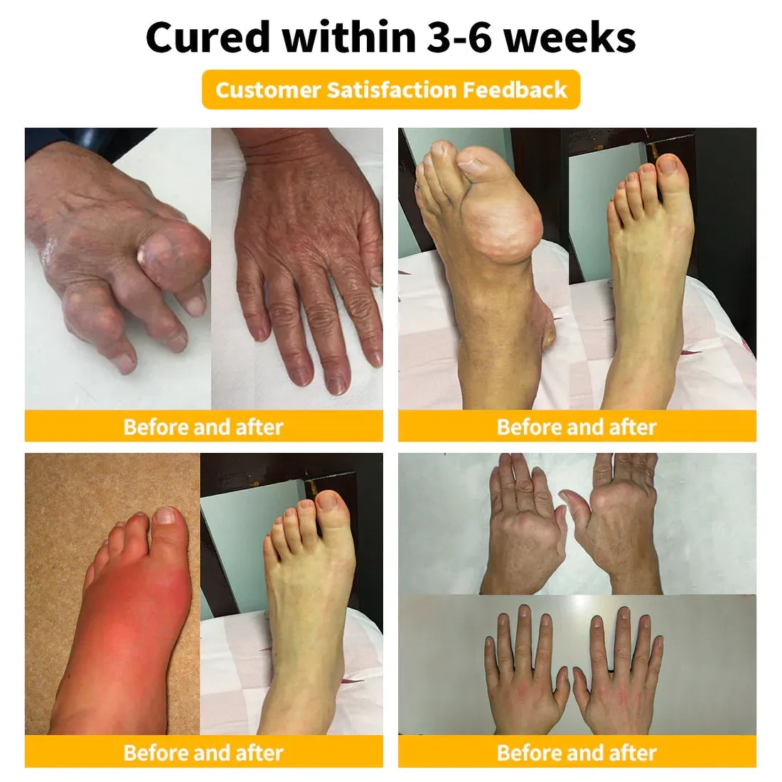 Flysmus™ Bee Venom Pain-Relief Bone Healing Cream(Specially for older adults & AOA recommends)