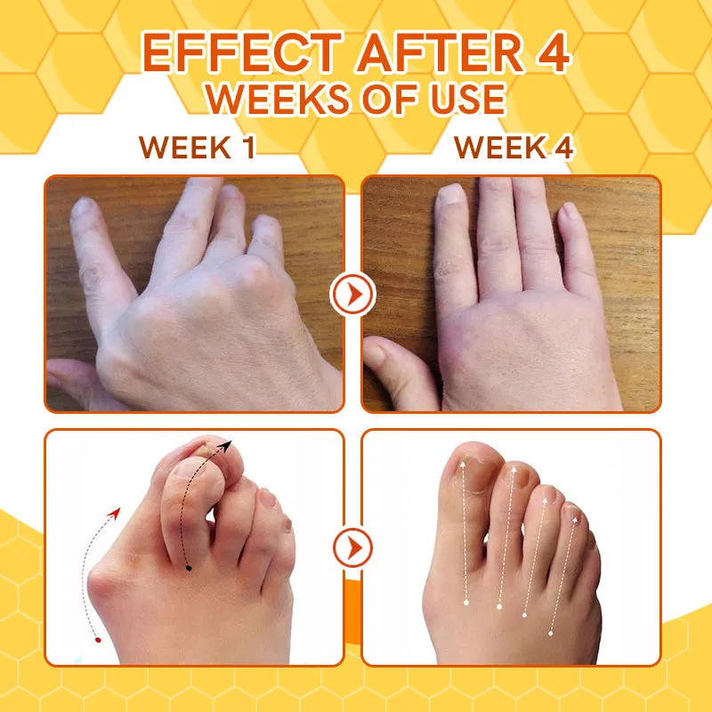 Furzero™ Bee Venom Joint Therapy Pain Relief Gel (New Zealand Bee Extract - especially for orthopedic conditions and arthritic pain)