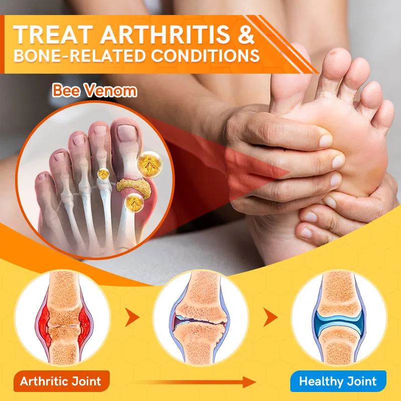 Furzero™ Bee Venom Joint Therapy Pain Relief Gel (New Zealand Bee Extract - especially for orthopedic conditions and arthritic pain)