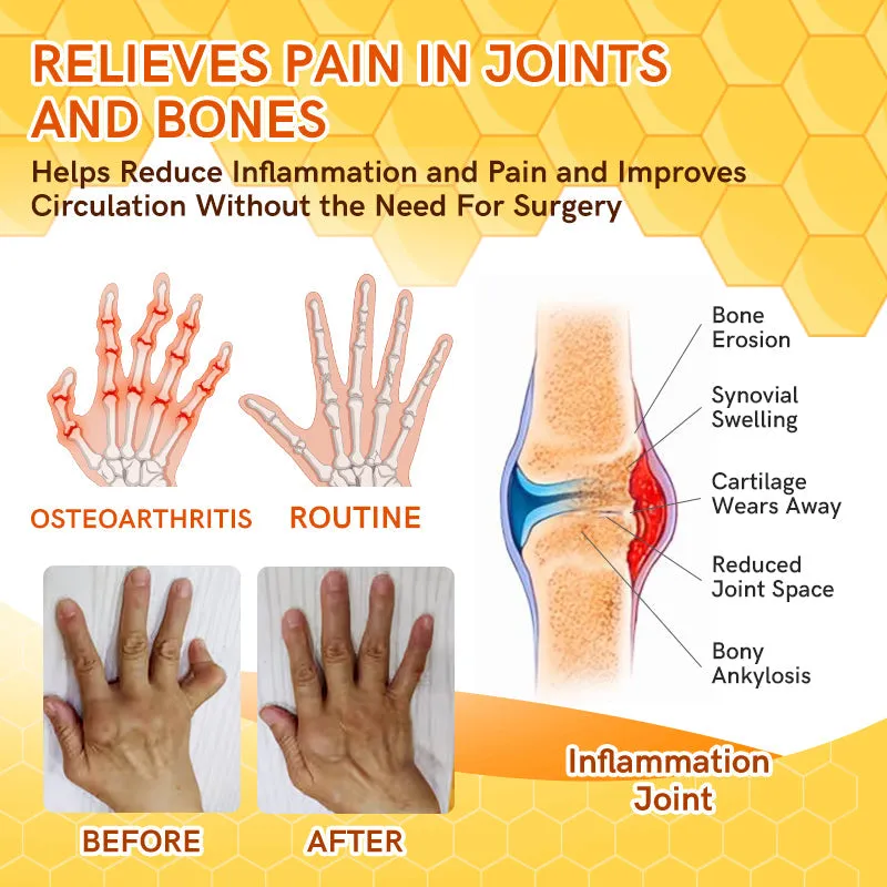 Furzero™ Bee Venom Joint Therapy Pain Relief Gel (New Zealand Bee Extract - especially for orthopedic conditions and arthritic pain)